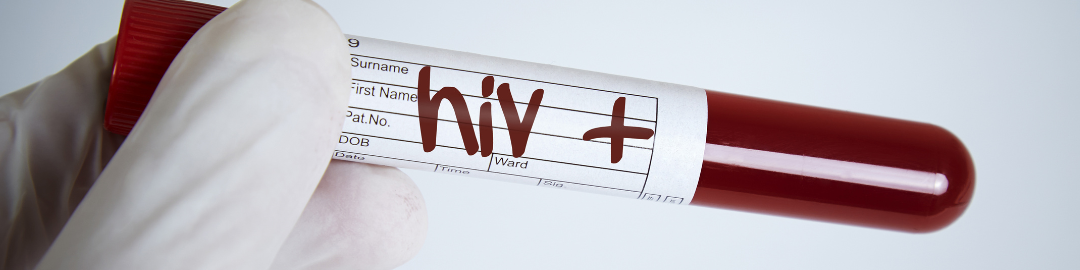 Sinais de que você pode ter contraído o vírus 