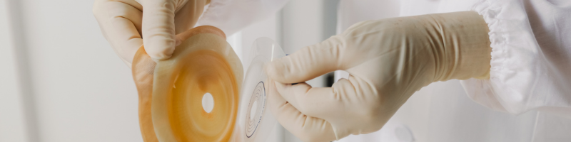 Cuidados essenciais com o estoma