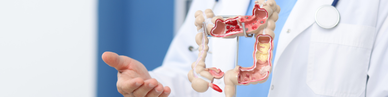 Enema e saúde intestinal