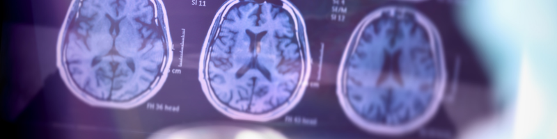 Causas e fatores de risco