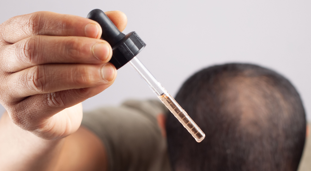 Minoxidil realmente funciona? Entenda os resultados e cuidados!