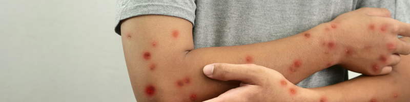 Por que os casos são monitorados de perto?