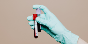 Lítio no sangue: por que esse exame é importante