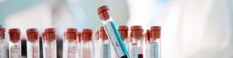 O que é o exame de lítio no sangue?