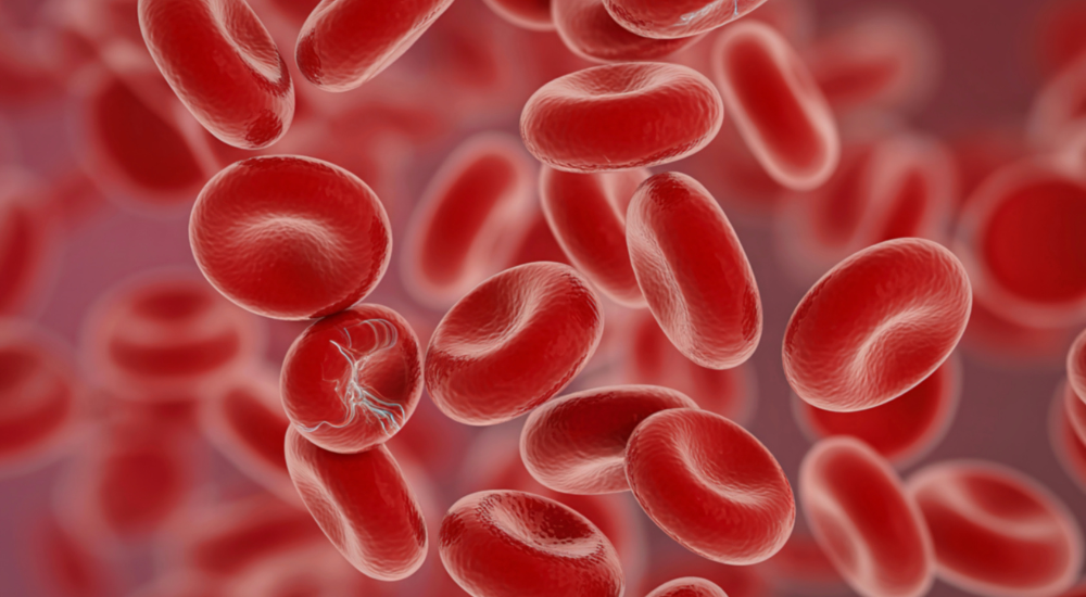 Hemoglobinopatias: o que são essas doenças
